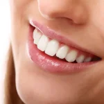 The Importance of Oral Health Before Cosmetic Work